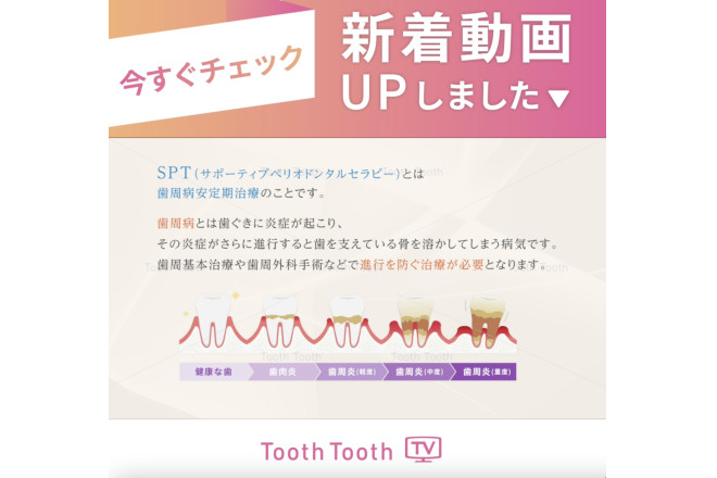 【新着動画のお知らせ✏️】「歯周病治療のカギはSPT」について