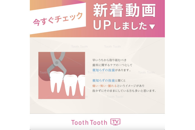 【新着動画のお知らせ✏️】早めに親知らずを抜いた方が良い理由